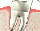 Periodontics